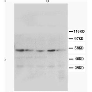 Anti-PPAR gamma Rabbit Polyclonal Antibody