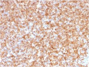 Immunohistochemical analysis of formalin-fixed, paraffin-embedded human tonsil using Anti-HLA DP + DQ + DR Antibody [CR3/43]