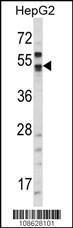 Anti-CA9 Rabbit Polyclonal Antibody (AP (Alkaline Phosphatase))