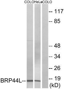 Antibody anti-BRP44L 100 µg