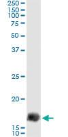 Anti-GEMIN7 Antibody Pair