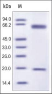 The purity of mouse PCSK9 was determined by DTT-reduced (+) SDS-PAGE and staining overnight with Coomassie Blue.