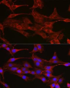 Anti-Thymidylate Synthase antibody