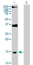 Anti-PRM1 Mouse Polyclonal Antibody