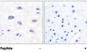 Anti-BACE Rabbit Polyclonal Antibody