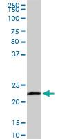 Anti-EFHD1 Mouse Monoclonal Antibody [clone: 1F5]