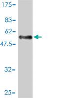 Anti-SH3BGR Mouse Monoclonal Antibody [clone: 3B7]