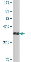 Anti-ZFYVE16 Mouse Polyclonal Antibody