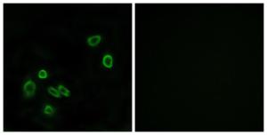 Antibody anti-BRP44L 100 µg