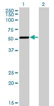 Anti-CAMK1G Mouse Monoclonal Antibody [clone: 3E2]