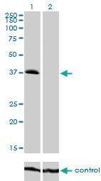 Anti-TRIB2 Mouse Monoclonal Antibody [clone: 1B1]