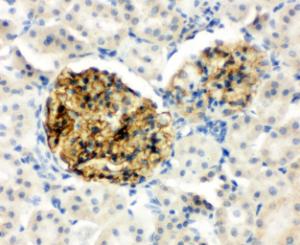 Anti-NPHS2 Rabbit Polyclonal Antibody