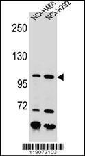 Anti-NBN Rabbit Polyclonal Antibody (APC (Allophycocyanin))