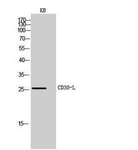 Western blot analysis of KB cells using Anti-TNFSF8 Antibody