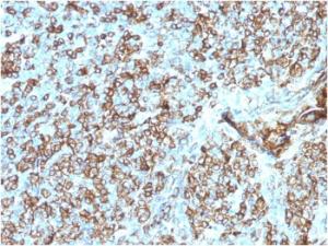 Immunohistochemical analysis of formalin-fixed, paraffin-embedded human tonsil using Anti-HLA DP + DQ + DR Antibody [CR3/43]