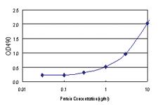 Anti-ZFYVE16 Antibody Pair