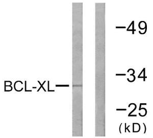 Western blot analysis of lysates from 293 cells, treated with UV 30' using Anti-BCL-XL Antibody. The right hand lane represents a negative control, where the Antibody is blocked by the immunising peptide