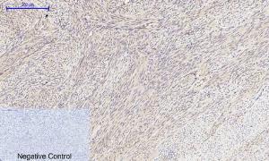 Immunohistochemical analysis of paraffin-embedded human uterus tissue using Anti-mTOR Antibody at 1:200 (4°C overnight). Negative control was secondary antibody only