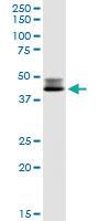 Anti-DLST Rabbit Polyclonal Antibody