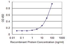 Anti-CAMK1G Mouse Monoclonal Antibody [clone: 3E2]