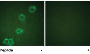 Anti-BACE Rabbit Polyclonal Antibody