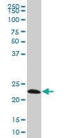 Anti-EFHD1 Mouse Monoclonal Antibody [clone: 1F5]