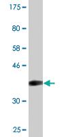 Anti-RBM15 Mouse Monoclonal Antibody [clone: 3E2]