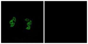 Immunofluorescence analysis of A549 cells using Anti-CSNK1A1L Antibody. The right hand panel represents a negative control, where the Antibody was pre-incubated with the immunising peptide