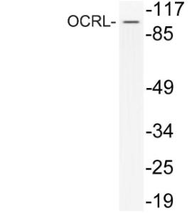 Anti-INPP5F Rabbit Polyclonal Antibody