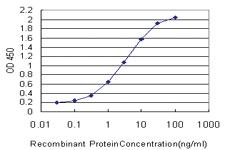 Anti-TRIB2 Mouse Monoclonal Antibody [clone: 1B1]