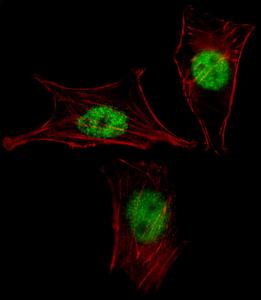 Anti-MEOX2 Rabbit Polyclonal Antibody