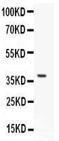 Anti-Stra8 Rabbit Polyclonal Antibody