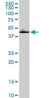 Anti-DLST Rabbit Polyclonal Antibody