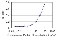 Anti-ZSCAN12 Mouse Monoclonal Antibody [clone: 3E4]