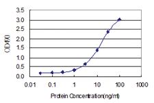 Anti-ZFYVE16 Polyclonal Antibody Pair