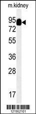 Anti-MEP1A Rabbit Polyclonal Antibody (AP (Alkaline Phosphatase))