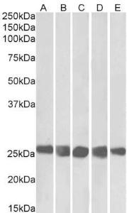 Anti-CSNK2B Antibody (A82927) (0.3 µg/ml) staining of NIH3T3 (A), HeLa (B), K562 (C), MCF7 (D) and HepG2 (E) lysates (35 µg protein in RIPA buffer). Primary incubation was 1 hour. Detected by chemiluminescence