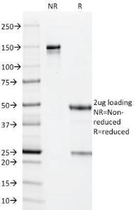 SDS-PAGE analysis of Anti-Cytomegalovirus p65 Antibody [CMV101] under non-reduced and reduced conditions; showing intact IgG and intact heavy and light chains, respectively. SDS-PAGE analysis confirms the integrity and purity of the antibody.