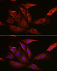 Anti-Thymidylate Synthase antibody