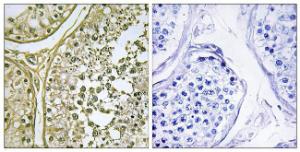 Immunohistochemical analysis of paraffin-embedded human testis tissue using Anti-CSNK1A1L Antibody. The right hand panel represents a negative control, where the Antibody was pre-incubated with the immunising peptide