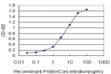 Anti-KMT2B Mouse Monoclonal Antibody [clone: 1F6]