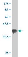 Anti-ZFYVE16 Mouse Monoclonal Antibody [clone: 4B9]