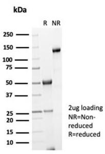 SDS-PAGE analysis of Anti-Galectin 3 Antibody [LGALS3/7036R] under non-reduced and reduced conditions; showing intact IgG and intact heavy and light chains, respectively. SDS-PAGE analysis confirms the integrity and purity of the antibody.