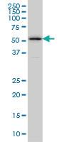 Anti-ZPR1 Mouse Monoclonal Antibody [clone: 6F7]