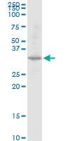 Anti-DECR2 Mouse Polyclonal Antibody