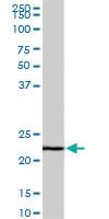 Anti-EFHD1 Mouse Monoclonal Antibody [clone: 1F5]