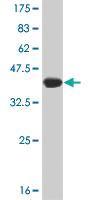 Anti-SMG1 Mouse Monoclonal Antibody [clone: 1C12]