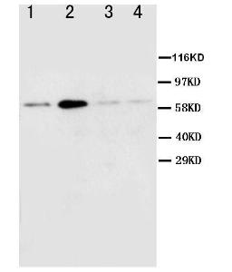 Anti-Muscarinic Acetylcholine Receptor 2 Rabbit Polyclonal Antibody