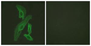 Immunofluorescence analysis of HeLa cells using Anti-BCL-XL Antibody. The right hand panel represents a negative control, where the Antibody was pre-incubated with the immunising peptide