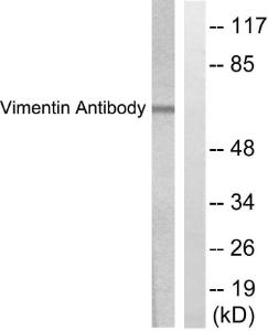 Anti-Vimentin Rabbit Polyclonal Antibody